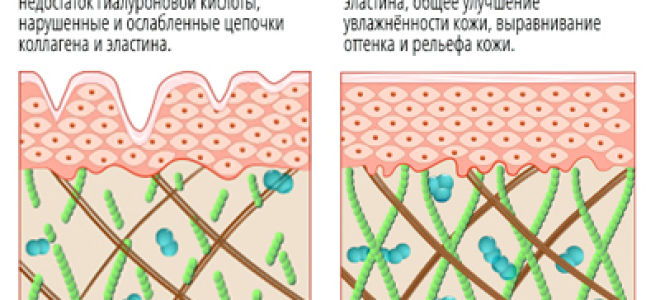 Лазерное омоложение лица: показания и противопоказания