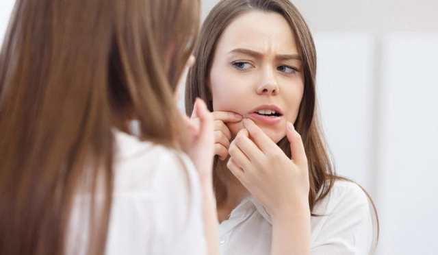 Угревая сыпь на лице: причины и лечение, профилактика