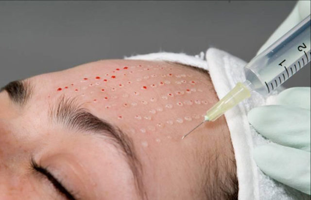 Уход за сухой кожей лица: рекомендуемые ежедневные процедуры