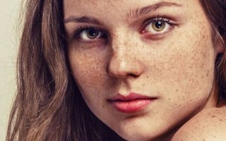Пятна на лице коричневые: причины и лечение