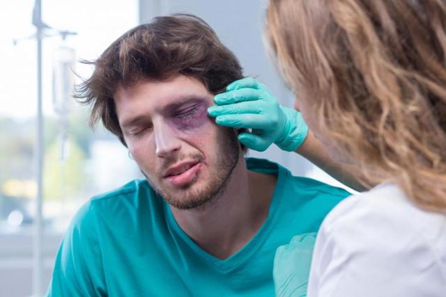 Как быстро убрать синяк под глазом: лекарства и народные методы