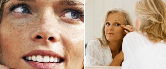 Причины пигментации на лице у женщин и способы борьбы с ней