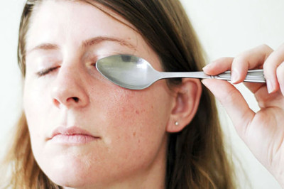 Синяки под глазами: эффективные методы их быстрого лечения