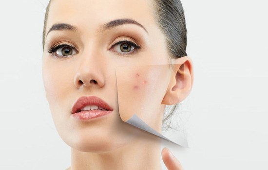 Высыпания на лице у женщин: причины появления, лечение