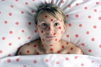 Красные точки на лице: причины и способы устранения