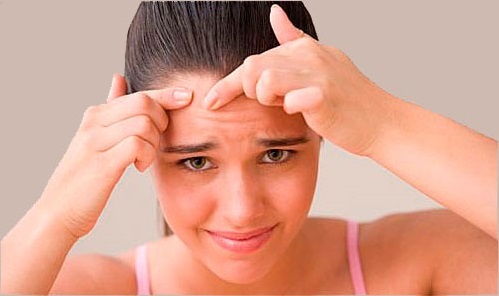 Потница на лице: лечение, причины, симптомы и профилактика